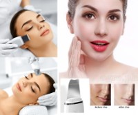 W-1188 Cordless Ultrasonic Facial Skin Scrubber USB-Rechargeable