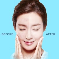 W-1888 Cordless Blackhead Remover / Skin Pore Vacuum Cleanser Set USB-Rechargeable